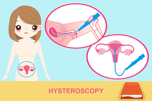 hysteroscopy
